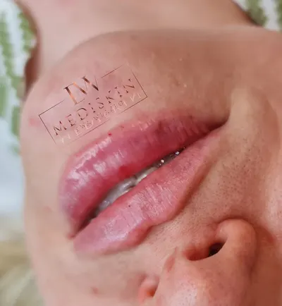 MediSkin Medycyna Estetyczna i Trychologia